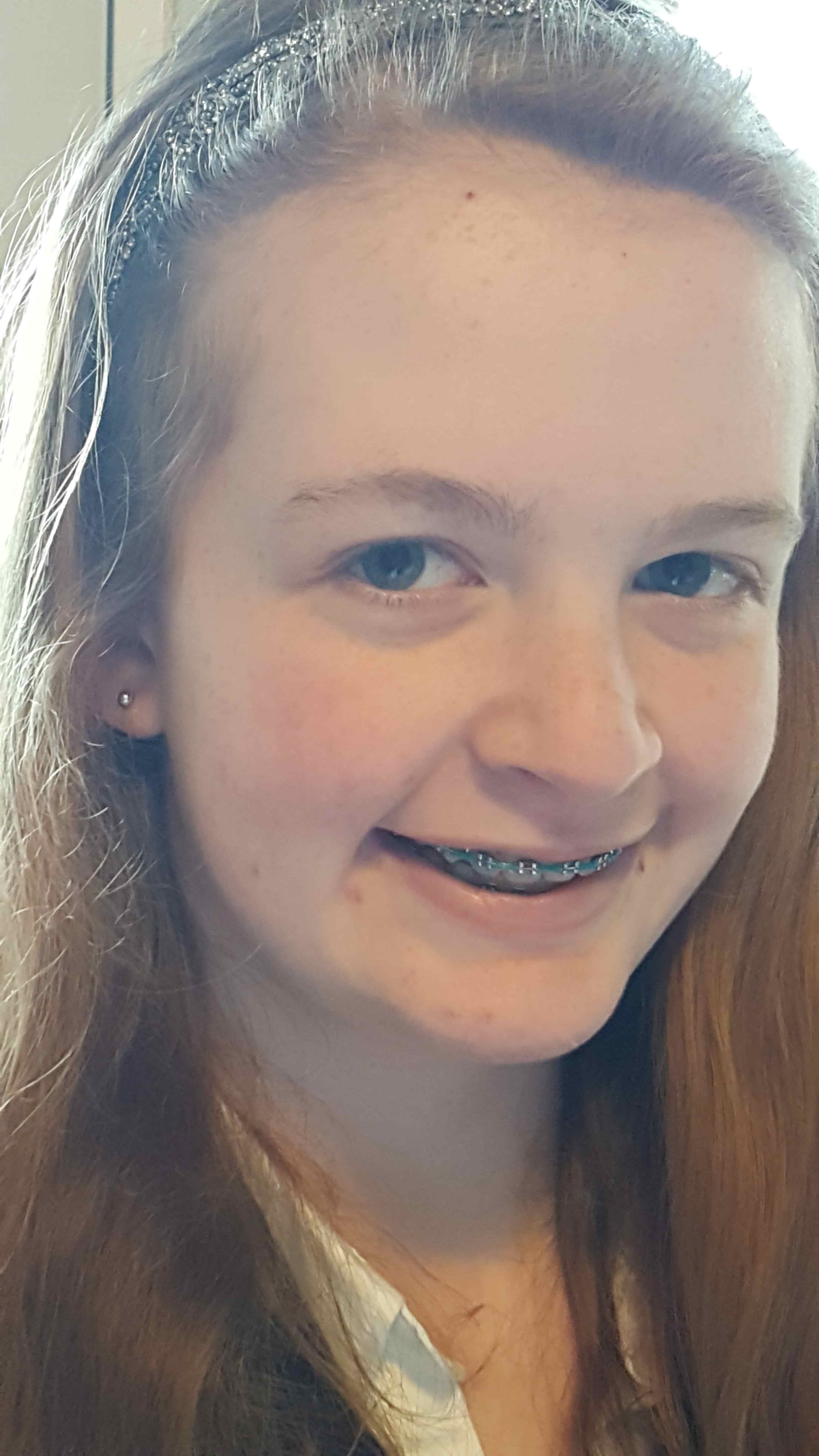 2016-12-28 Janes last picture with braces.jpg